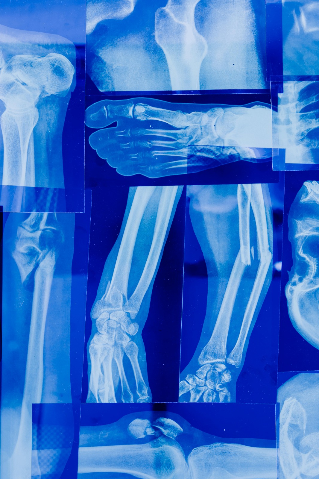 Radiografias